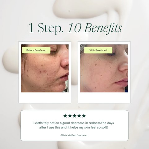Barefaced ad, running 75 days