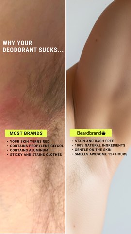 Beardbrand ad, running 301 days